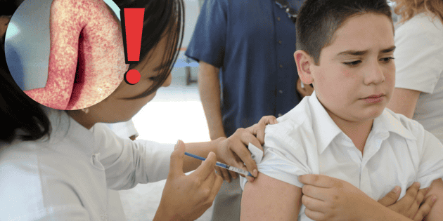 Sarampi&oacute;n: Salud declar&oacute; que 90 % de los infectados no est&aacute;n vacunados contra el virus