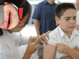 El primer brote del actual periodo se registró en Chihuahua en febrero de 2025. NTX / ARCHIVO / ESPECIAL / IMSS