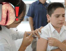 El primer brote del actual periodo se registró en Chihuahua en febrero de 2025. NTX / ARCHIVO / ESPECIAL / IMSS