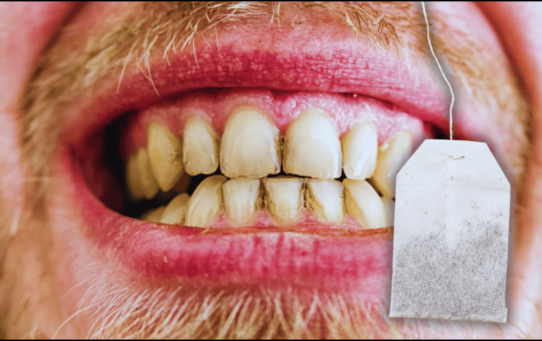 La preparación del té depende de los gustos de cada persona, pero algunas formas pueden causar problemas a los dientes. ESPECIAL / CANVA