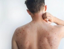 De acuerdo con la Organización Mundial de la Salud (OMS), hay algunas acciones que puedes realizar para mejorar algunos síntomas. ESPECIAL/Canva