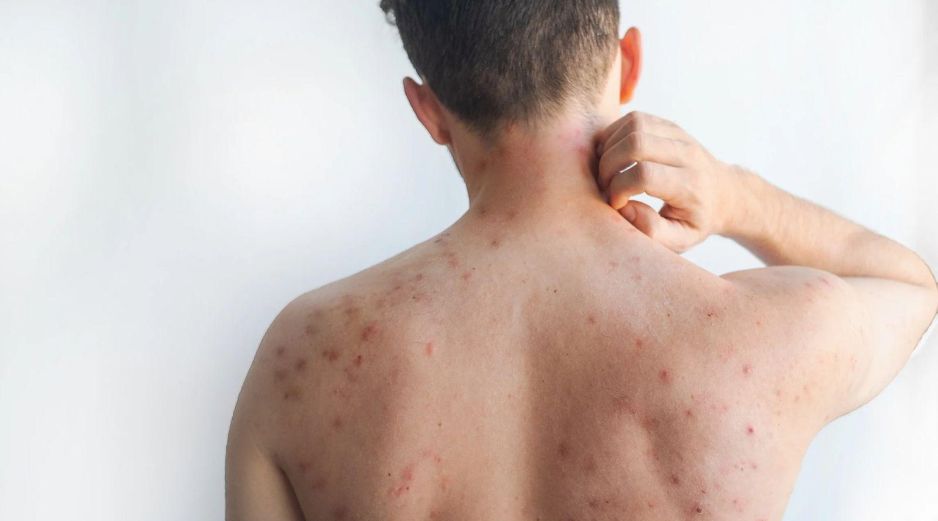 De acuerdo con la Organización Mundial de la Salud (OMS), hay algunas acciones que puedes realizar para mejorar algunos síntomas. ESPECIAL/Canva