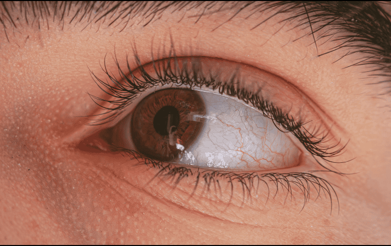 La miopía se desarrolla cuando la iluminación deficiente de la retina no genera una actividad retiniana sólida. ESPECIAL