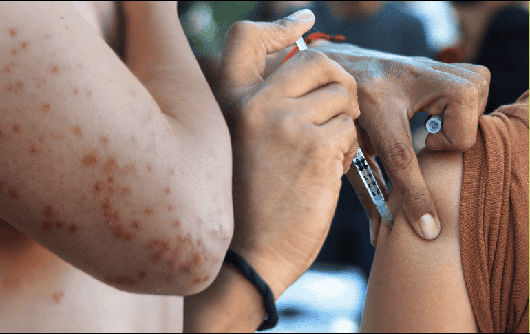 México superó esta semana los 10 mil casos de sarampión confirmados desde enero del año pasado. EL INFORMADOR/ARCHIVO ESPECIAL/Canva