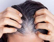 Las canas son naturales y no siempre aparecen por edad, también influyen la genética. CANVA