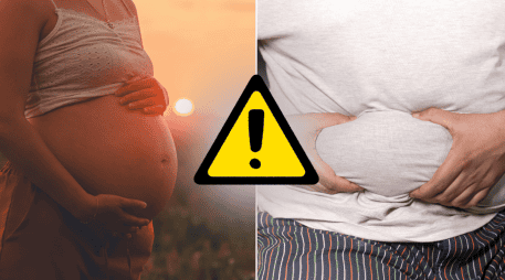 El sobrepeso y la obesidad se asociaron de forma independiente con un mayor riesgo de que los hijos acabaran sufriendo MASLD. CANVA/ESPECIAL