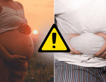 El sobrepeso y la obesidad se asociaron de forma independiente con un mayor riesgo de que los hijos acabaran sufriendo MASLD. CANVA/ESPECIAL