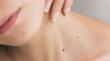 La aplicación de tratamientos naturales puede complementar la rutina de cuidado diario. A. ECHEVERRY