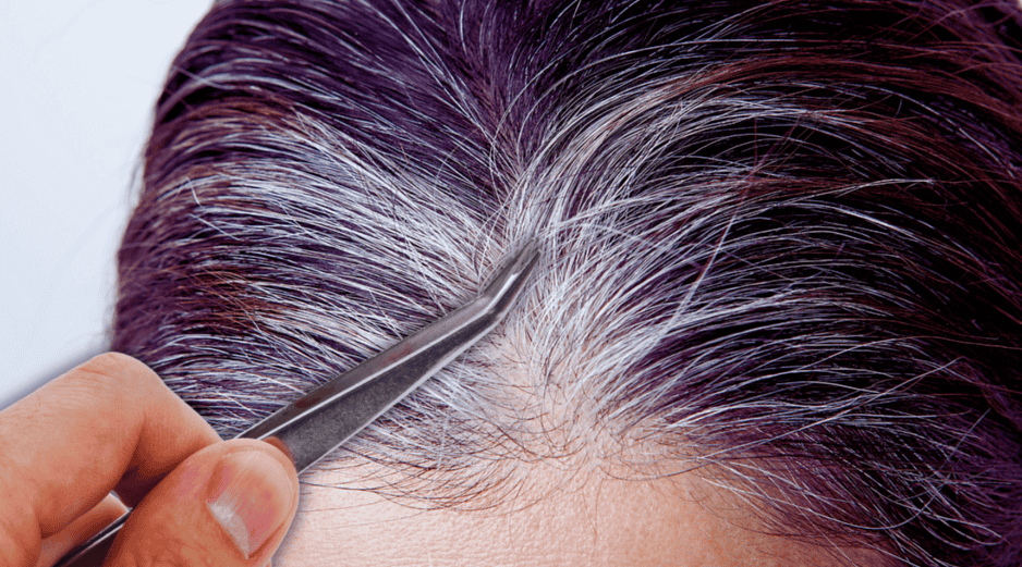 Arrancar las canas con los dedos o pinzas puede provocar pérdida anormal de cabello, también conocida como alopecia. ESPECIAL / CANVA