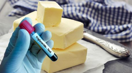 El diagnóstico de los niveles altos de triglicéridos se realiza a través de una prueba de sangre que también evalúa los niveles de colesterol. ESPECIAL / CANVA
