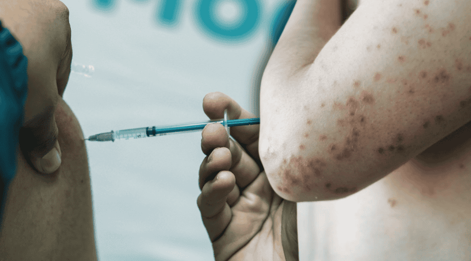 El secretario destacó que las jornadas masivas de vacunación y la implementación del uso de cubrebocas en las escuelas han permitido contener el brote de sarampión. EL INFORMADOR/ARCHIVO ESPECIAL/Canva