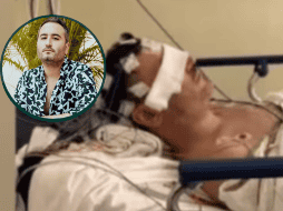 el músico aseguró que “todo se ve más grave de lo que es”, buscando reducir la preocupación que generaron las imágenes. INSTAGRAM/chuinavarro