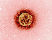 El Herpes Zóster es un sarpullido que aparece en forma de pequeñas ampollas en la piel. UNSPLASH /