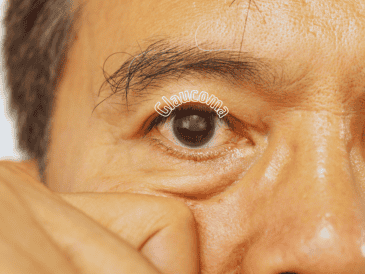 El glaucoma puede presentarse a cualquier edad, pero suele ser más común en adultos mayores. ESPECIAL / CANVA