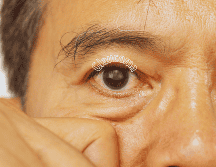 El glaucoma puede presentarse a cualquier edad, pero suele ser más común en adultos mayores. ESPECIAL / CANVA