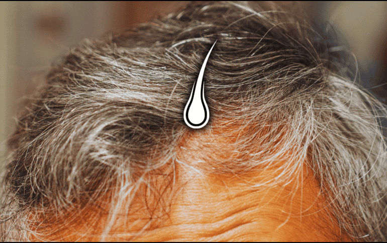 A medida que disminuye la capacidad de los melanocitos para producir melanina, el pelo empieza a volverse blanco. ESPECIAL / CANVA