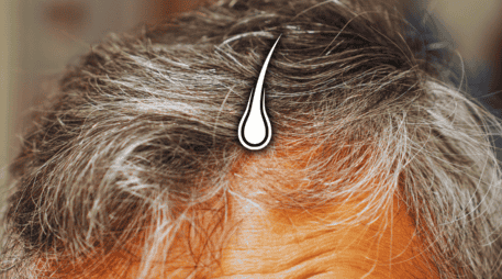 A medida que disminuye la capacidad de los melanocitos para producir melanina, el pelo empieza a volverse blanco. ESPECIAL / CANVA