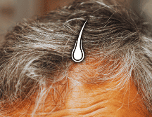 A medida que disminuye la capacidad de los melanocitos para producir melanina, el pelo empieza a volverse blanco. ESPECIAL / CANVA