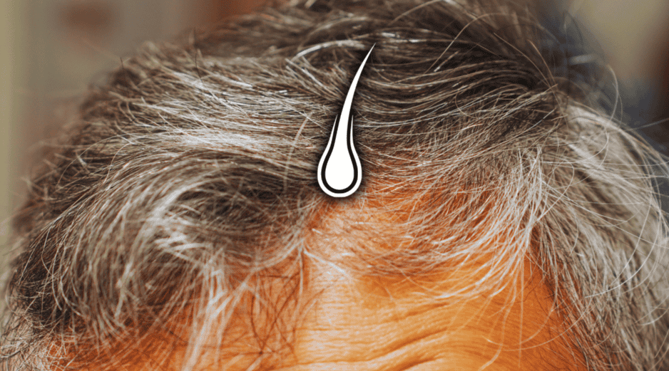 A medida que disminuye la capacidad de los melanocitos para producir melanina, el pelo empieza a volverse blanco. ESPECIAL / CANVA