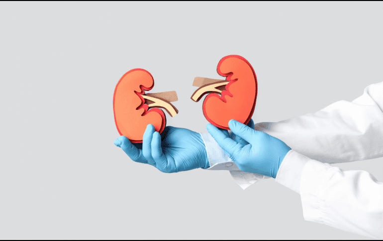 Aunque no se trata de un diagnóstico formal ampliamente establecido, diversos estudios han señalado que esta acumulación de grasa renal puede estar relacionada con enfermedades como la diabetes tipo 2. CANVA