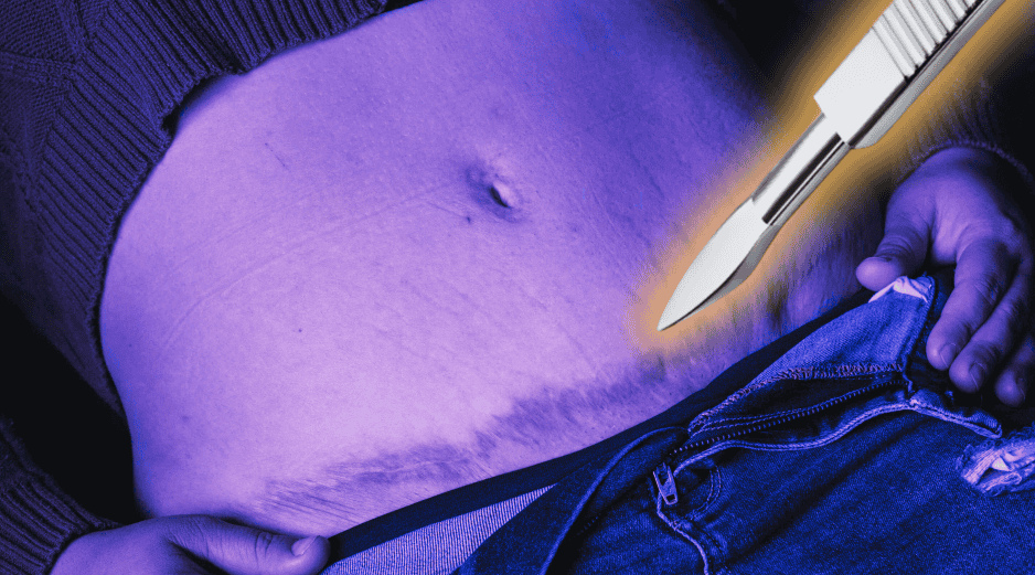 Esta iniciativa se suma a otra que presentada en septiembre de 2025 para prohibir los procedimientos estéticos en menores de edad. SUN/ARCHIVO