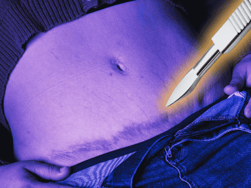 Esta iniciativa se suma a otra que presentada en septiembre de 2025 para prohibir los procedimientos estéticos en menores de edad. SUN/ARCHIVO