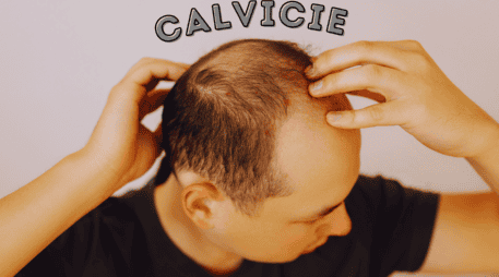 Las estadísticas sobre la calvicie a nivel mundial señalan que, a partir de los 25 años, 1 de cada 4 hombres comienza a sufrir pérdida de cabello. ESPECIAL / CANVA