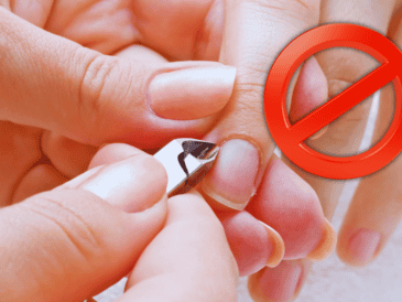 Cortar este pedazo de piel cerca de la uña puede causar daños permanentes, por ejemplo, deformidades, surcos, ondulaciones o cambios en el grosor. ESPECIAL / CANVA