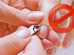 Cortar este pedazo de piel cerca de la uña puede causar daños permanentes, por ejemplo, deformidades, surcos, ondulaciones o cambios en el grosor. ESPECIAL / CANVA