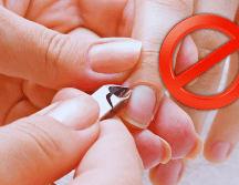 Cortar este pedazo de piel cerca de la uña puede causar daños permanentes, por ejemplo, deformidades, surcos, ondulaciones o cambios en el grosor. ESPECIAL / CANVA