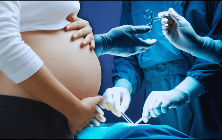 Descubre cómo la cesárea está provocando que los bebés nazcan antes de tiempo, con menor peso y talla, afectando su desarrollo óptimo desde el primer día. EL INFORMADOR / ARCHIVO