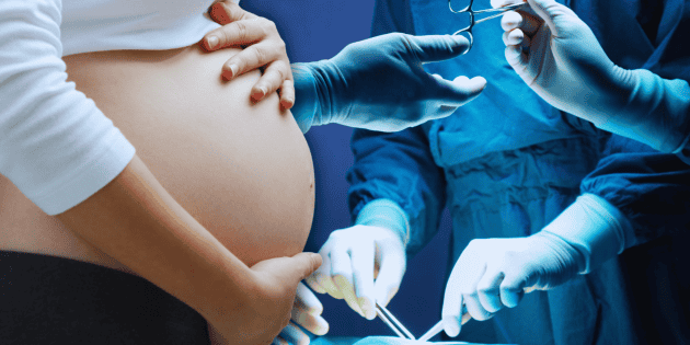 El impacto oculto de las ces&aacute;reas en la salud de los beb&eacute;s mexicanos
