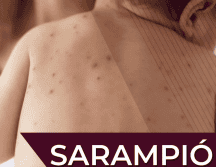 La campaña de vacunación contra el sarampión continúa activa durante abril del presente año; se recomienda acudir a vacunarse, especialmente si se tiene el esquema incompleto. Gobierno de México