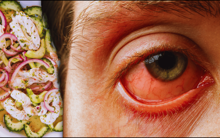 La infección asociada al nodavirus de mortalidad encubierta se manifiesta principalmente como uveítis viral anterior, una inflamación severa del ojo. ESPECIAL / CANVA