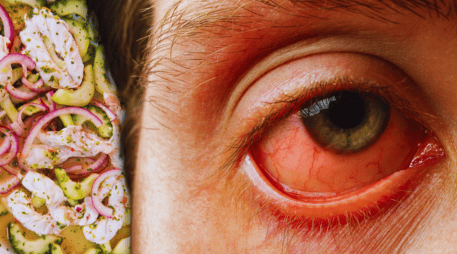 La infección asociada al nodavirus de mortalidad encubierta se manifiesta principalmente como uveítis viral anterior, una inflamación severa del ojo. ESPECIAL / CANVA