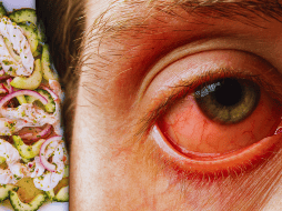 La infección asociada al nodavirus de mortalidad encubierta se manifiesta principalmente como uveítis viral anterior, una inflamación severa del ojo. ESPECIAL / CANVA