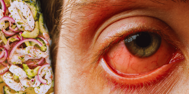 As&iacute; es el extra&ntilde;o virus de los mariscos y pescados que est&aacute; causando graves da&ntilde;os visuales en humanos