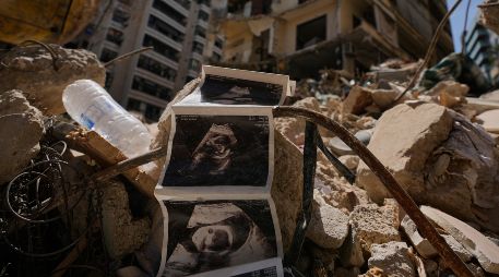 Imágenes de ecografías de un bebé yacenentre los escombros de un edificio destruido que fue alcanzado hace una semana por un bombardeo israelí contra el centro de Beirut, Líbano. AP/H. Malla