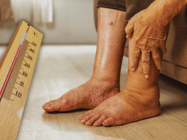 Las mujeres embarazadas, los adultos mayores de sesenta años y los pacientes con problemas circulatorios previos encabezan la lista de mayor riesgo clínico. ESPECIAL / CANVA