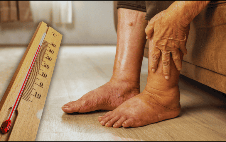 Las mujeres embarazadas, los adultos mayores de sesenta años y los pacientes con problemas circulatorios previos encabezan la lista de mayor riesgo clínico. ESPECIAL / CANVA