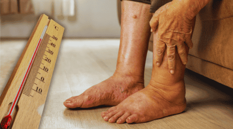 Las mujeres embarazadas, los adultos mayores de sesenta años y los pacientes con problemas circulatorios previos encabezan la lista de mayor riesgo clínico. ESPECIAL / CANVA