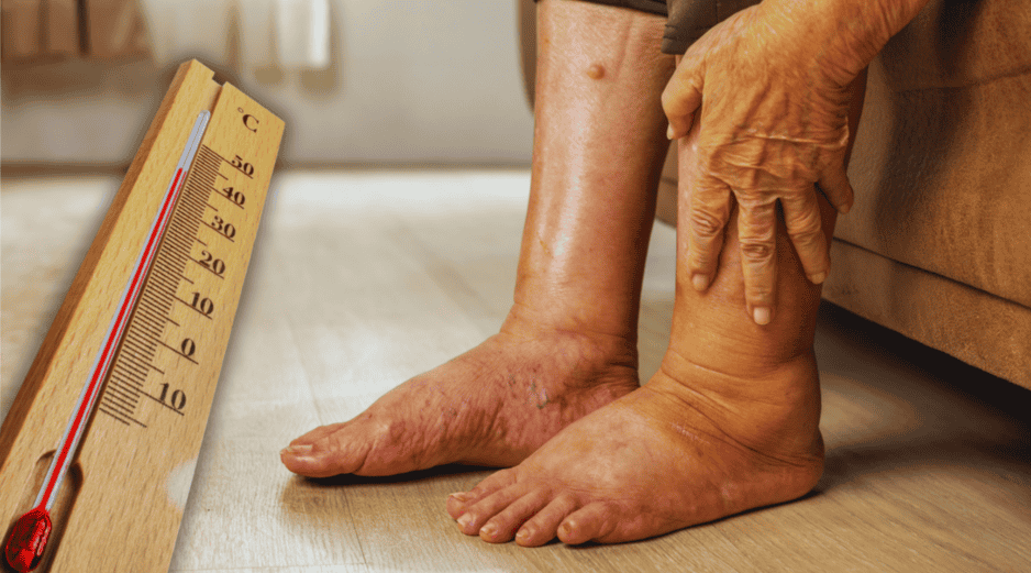 Las mujeres embarazadas, los adultos mayores de sesenta años y los pacientes con problemas circulatorios previos encabezan la lista de mayor riesgo clínico. ESPECIAL / CANVA