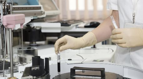 El padecimiento es causado por la larva de la mosca Cochliomyia hominivorax, que deposita sus huevecillos en heridas abiertas. ESPECIAL/PEXELS