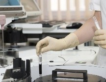 El padecimiento es causado por la larva de la mosca Cochliomyia hominivorax, que deposita sus huevecillos en heridas abiertas. ESPECIAL/PEXELS