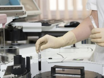 El padecimiento es causado por la larva de la mosca Cochliomyia hominivorax, que deposita sus huevecillos en heridas abiertas. ESPECIAL/PEXELS