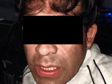 El detenido fue identificado como José de Jesús “N”, de 36 años de edad, quien fue puesto a disposición de la Fiscalía del Estado. ESPECIAL
