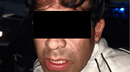 El detenido fue identificado como José de Jesús “N”, de 36 años de edad, quien fue puesto a disposición de la Fiscalía del Estado. ESPECIAL