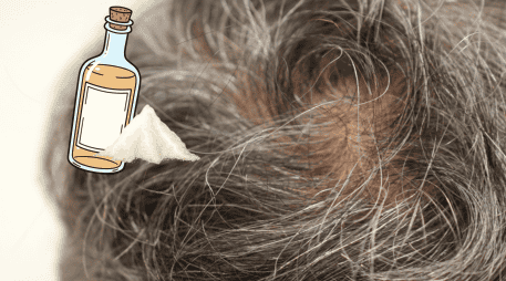 Para quienes buscan tratar las canas de forma más efectiva, especialistas recomiendan acudir con dermatólogos o profesionales capilares antes de probar tratamientos virales que podrían afectar la salud del cuero cabelludo. CANVA