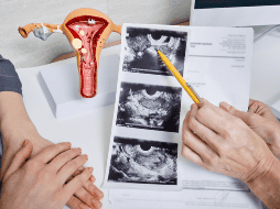 Más allá del nuevo nombre, especialistas coinciden en que el gran desafío sigue siendo lograr una atención médica integral. CANVA