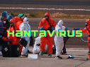 La infección por hantavirus humano se contrae principalmente a través del contacto con la orina, las heces o la saliva de roedores infectados, o al tocar superficies contaminadas. AP / ARCHIVO